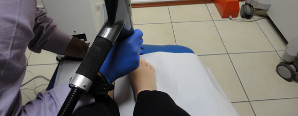 LASER TREATMENT OF ONYCHOMYCOSIS