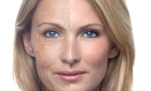 BOTOX antigiransi