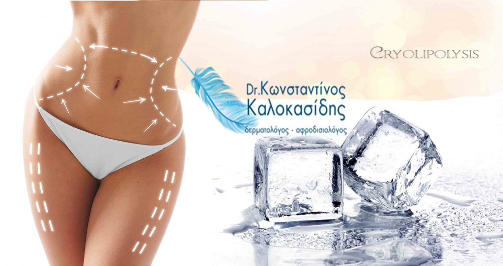 cryolipolysis - 3