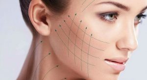 „Flüssiges“ Facelift Nicht-chirurgischer Ansatz für ein vollständiges Facelift